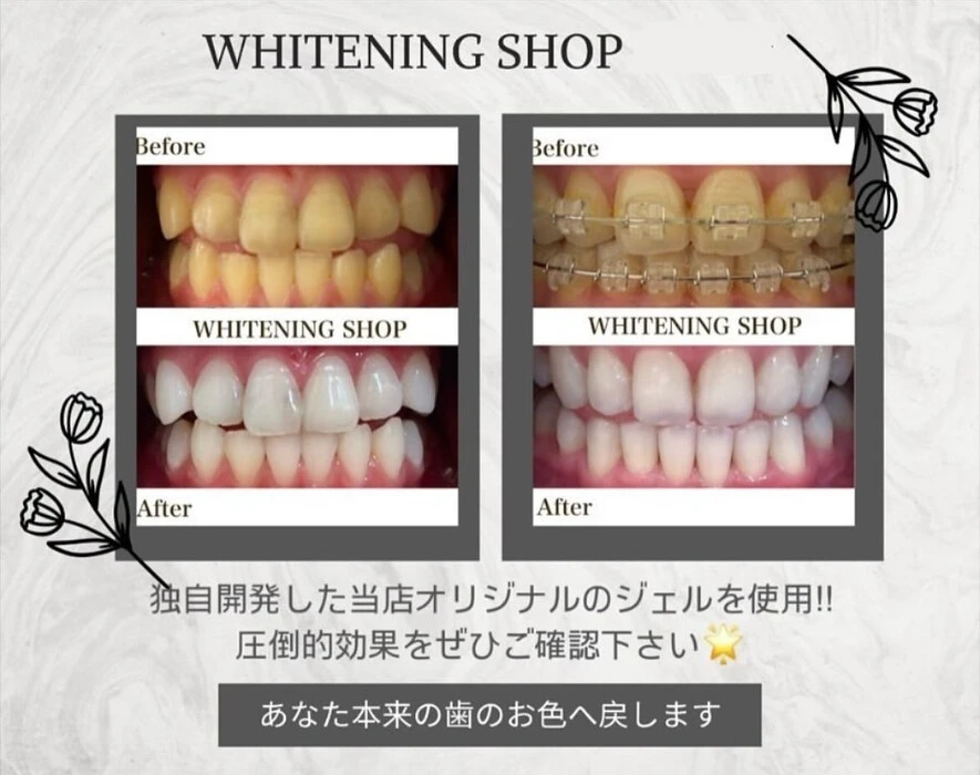 画像1133