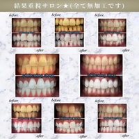 画像531