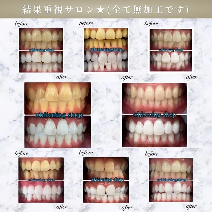 画像542