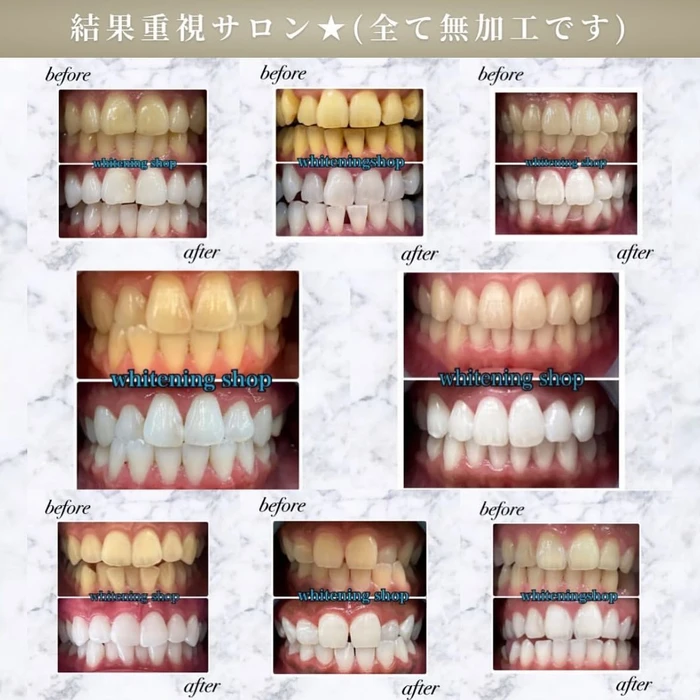 画像547