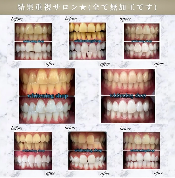 画像614