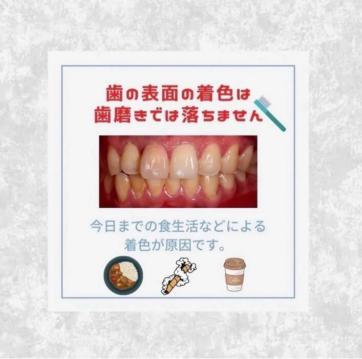 画像890